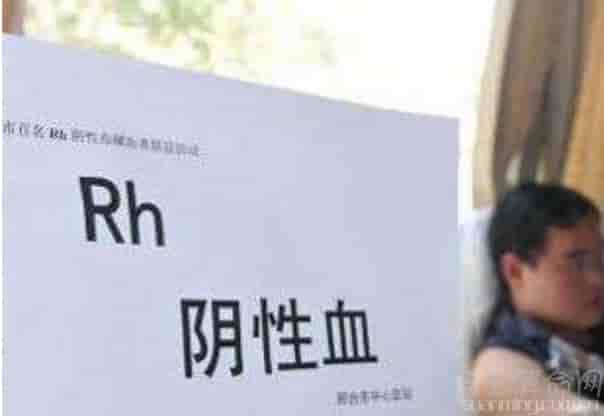 熊猫血型是什么意思   熊猫血型是非常稀有的血型